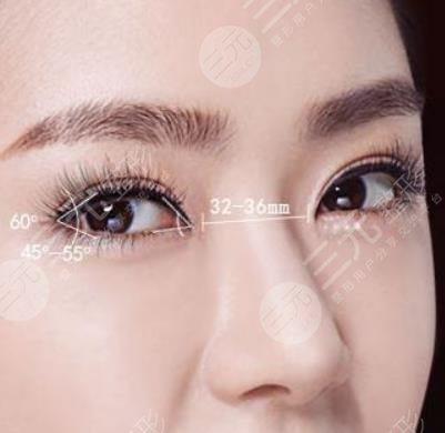 开眼角手术的价格