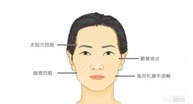 脂肪填充太阳凹陷能维持多久?脂肪填充的优势有哪些?