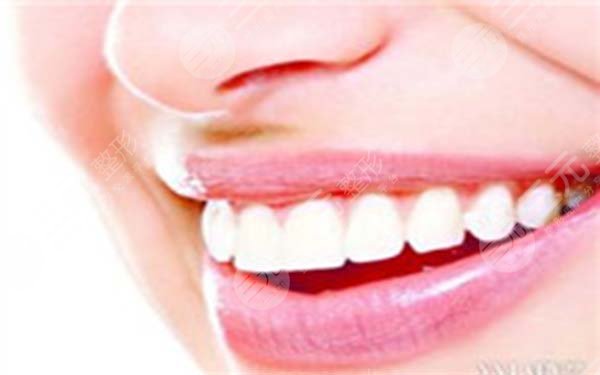 种植牙的利与弊