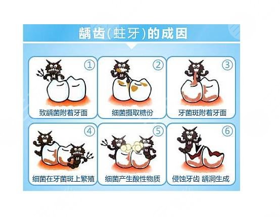 哪些因素会影响补牙价格
