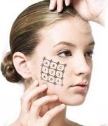 热玛吉FLX和4代区别科普！到底要不要花大钱？看明白再说！