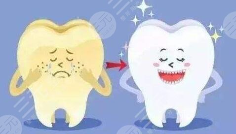 冷光美白牙齿的步骤详解