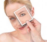 复合彩光嫩肤怎么样？缓解果好不好？复合彩光嫩肤注意事项