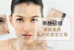果酸换肤痘印能掉吗？做几次有果？“战痘”经验大赏~
