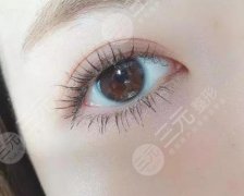 韩式or欧式双眼皮合适更好，本文帮你分析到底适合什么风格的~