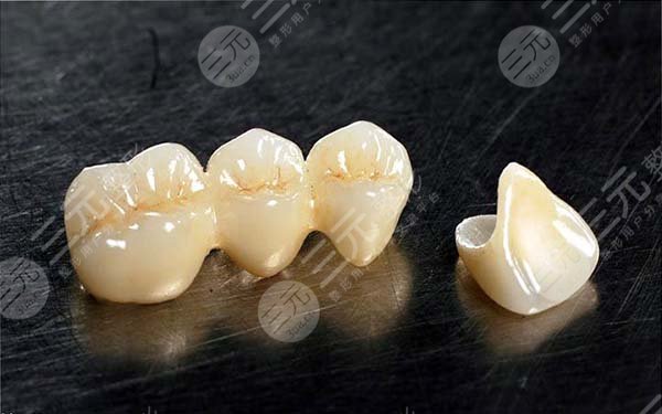 钴铬烤瓷牙和镍铬烤瓷牙哪个好