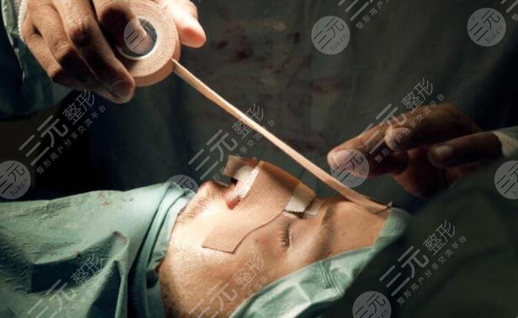 隆鼻修复要多久恢复期？隆鼻修复贵不贵？隆鼻修复真人日记