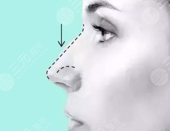 需要在家庭中注意的事情