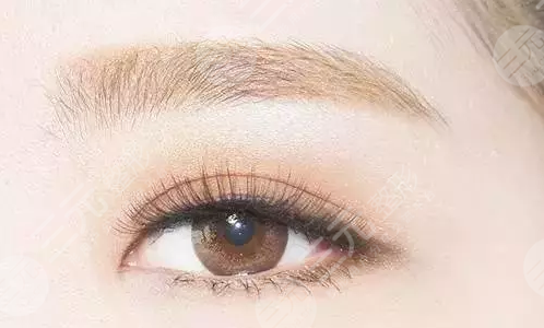 植眉毛多久能恢复正常？植眉手术成好吗？有哪些注意事项呢？