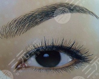 植眉手术的注意事项