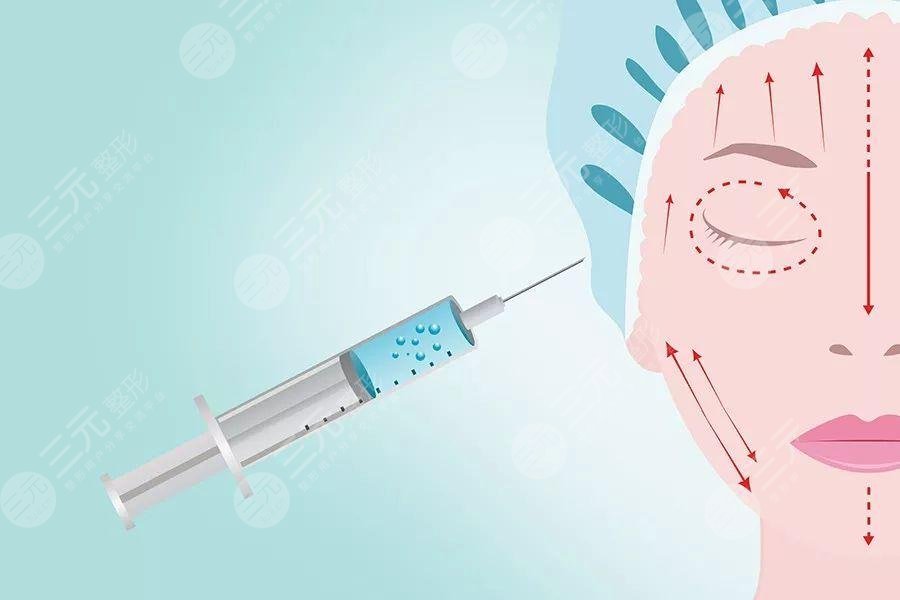 怎么去除额头皱纹