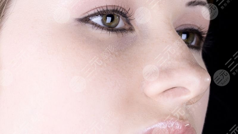 驼峰鼻手术一般多少钱比较合适？驼峰鼻手术价格|手术注意事项须知！