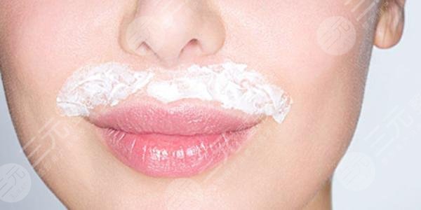 女人唇部脱毛多少钱