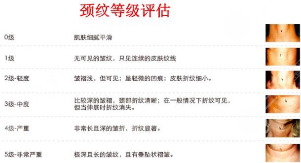 颈部皮肤除皱术有哪些？3种常用方法科普，想要天鹅美颈就瞧瞧叭！