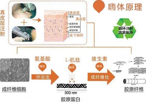 颈部皮肤除皱