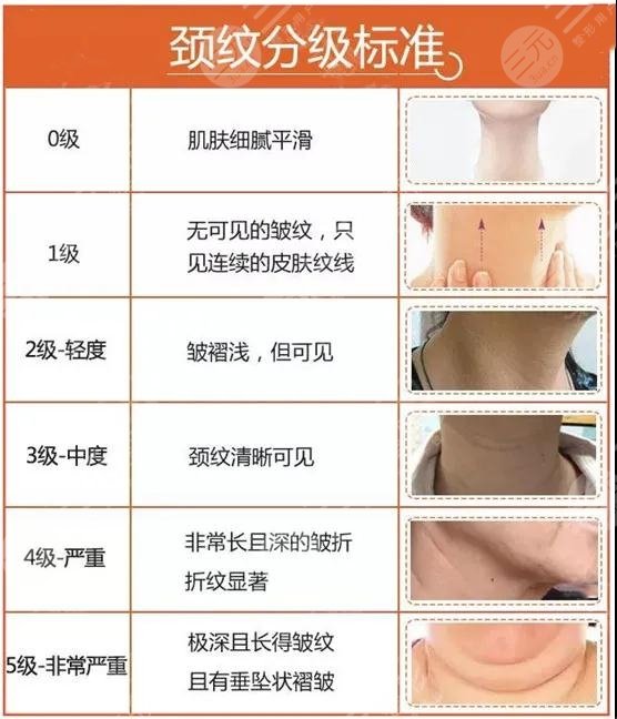 颈纹