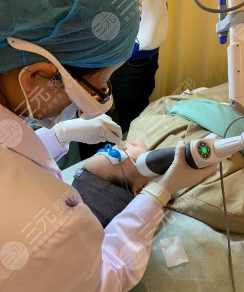 光子嫩肤过程