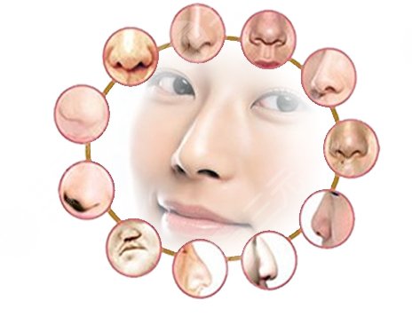 畸形鼻部整形要多少钱？超全干货科普&注意事项！