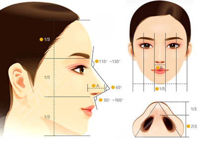 驼峰鼻矫正的缓解费用