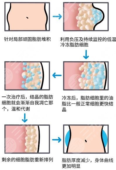 酷塑溶脂