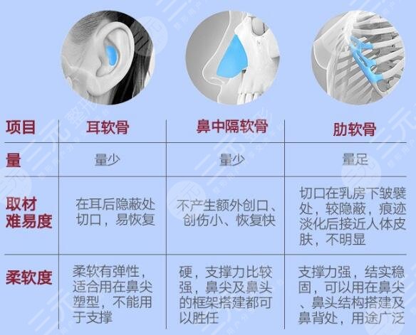 自体软骨隆鼻缺点