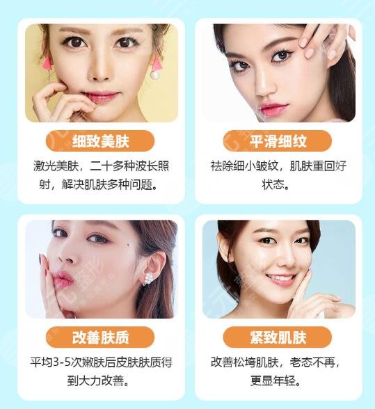 光子嫩肤的优势