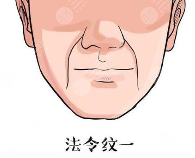 自体脂肪填充鼻唇沟术前需要注意什么