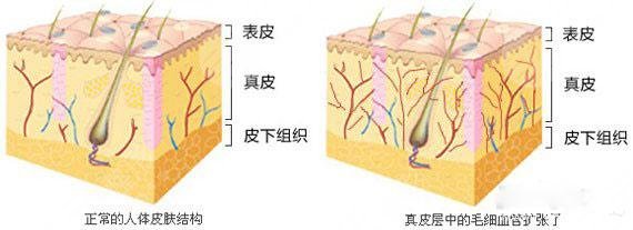 什么能去红血丝