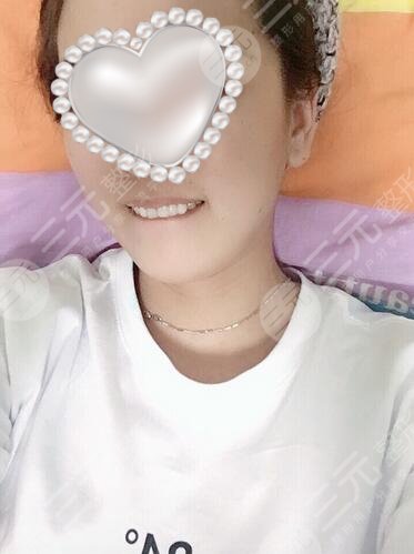 纯钛烤瓷牙案例