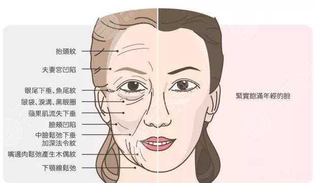 有法令纹怎么办?3种方法帮你搞定细纹,年龄苦恼say no! 有法令纹怎么办?3种方法帮你搞定细纹,年龄苦恼say no!