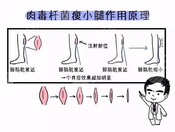 瘦小腿的原理