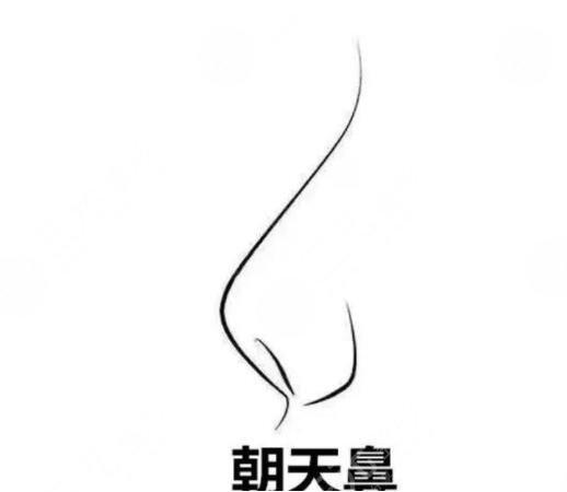 什么是朝天鼻