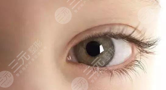 韩式or欧式双眼皮有什么区别