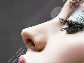 自体软骨隆鼻术多少钱