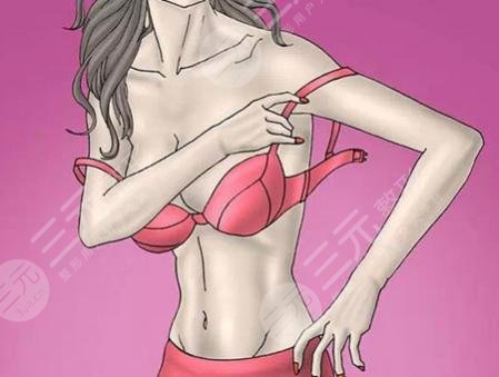 副乳切除手术几天恢复