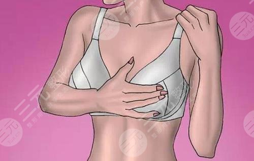 副乳切除手术几天恢复