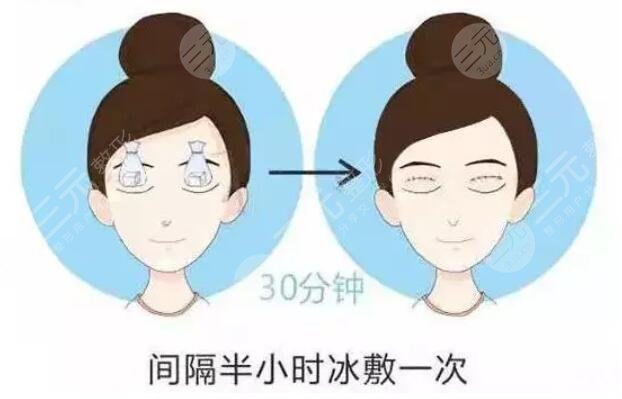 做双眼皮手手术注意事项