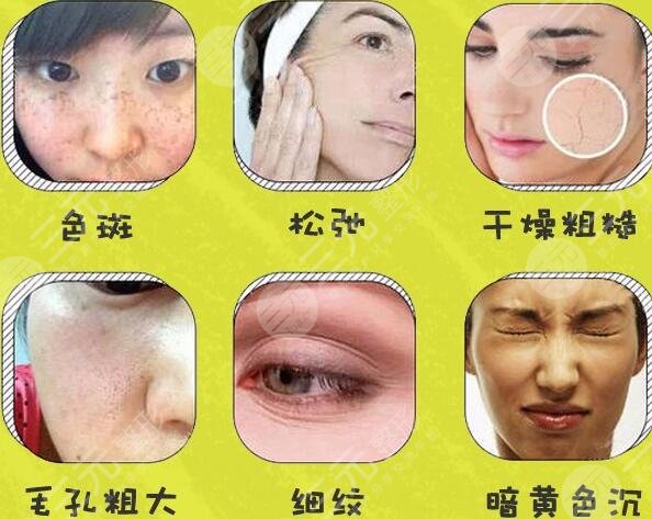 白瓷娃娃适用人群