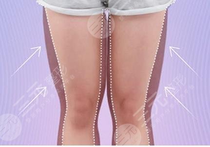 怎样才可以瘦腿比较快？教你几个小技巧，轻松瘦腿不是梦！