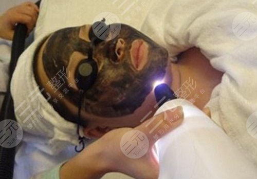 做黑脸娃娃有副作用吗？黑脸娃娃的注意事项有哪些？