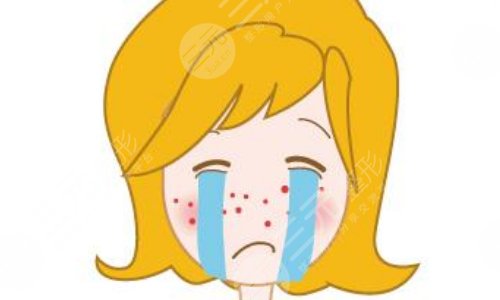 做几次果酸才明X祛痘印？科普告诉你想美不能急！