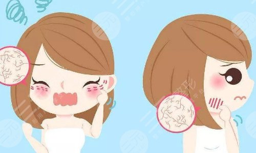 果酸换肤一辈子一直都要做吗