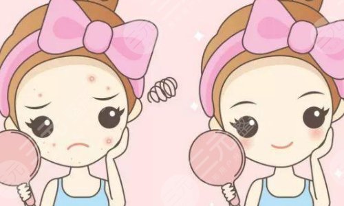 果酸换肤