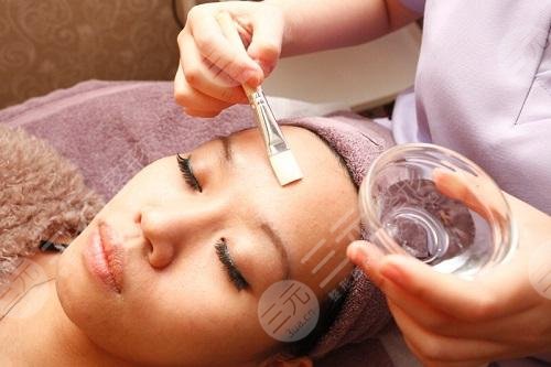 果酸换肤是什么