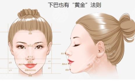 垫下巴的价位大概是多少钱