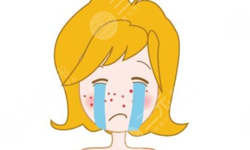 像素激光去痘印果怎么样？像素激光去痘印价格及术后护理