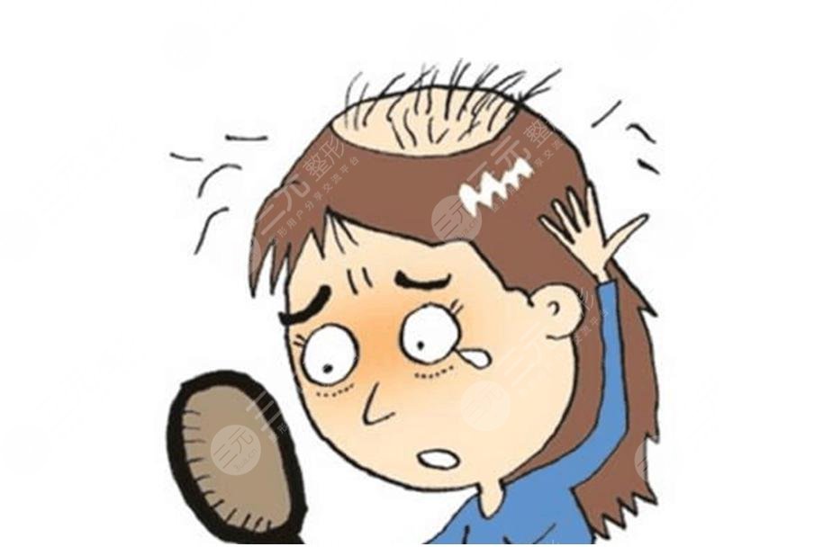 如何改良头发脱落的问题