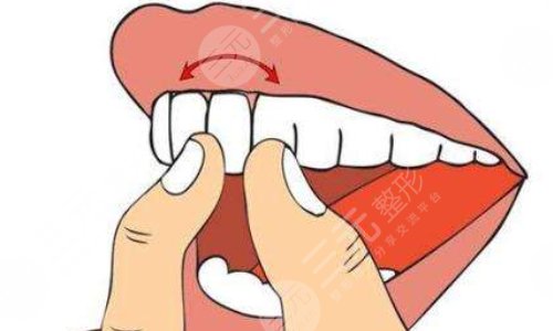 牙齿松动怎么治好的办法