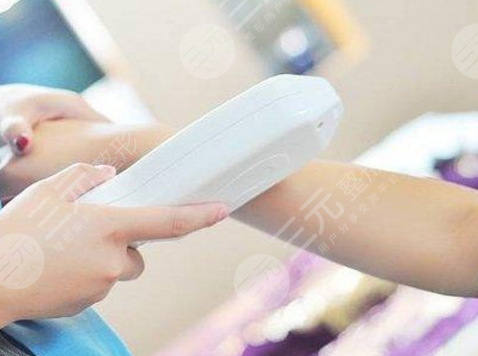 冰点脱毛有副作用吗