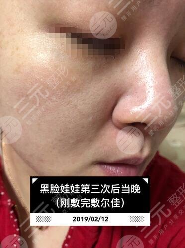 　黑脸娃娃亲身体验案例